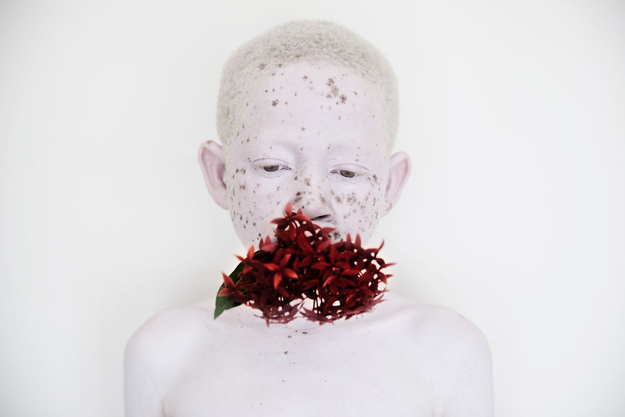 Stunning Photos Show The Beauty Of Albino Children To Raise Awareness Of Their Heartbreaking Situation In Tanzania Stunning Photos Show The Beauty Of Albino Children To Raise Awareness Of Their Heartbreaking Situation In Tanzania