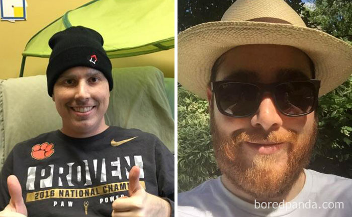 Cancer Diagnoses Was 11 Months Ago. Spent ~5 Months Of The Last Year In The Hospital. After My Stem Cell Transplant I Am Finally Cancer Free And Beard Full Once Again!