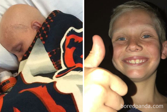 My Son Ryan Is Cancer Free For 3 Months