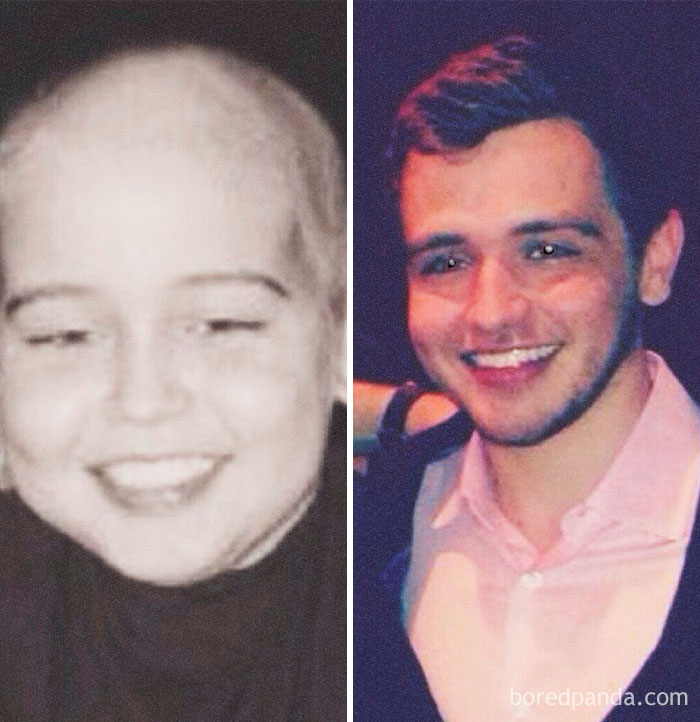 10 Years Cancer Free Today And I Feel Absolutely Blessed. It's Been A Long Journey But Life Keeps Getting Better