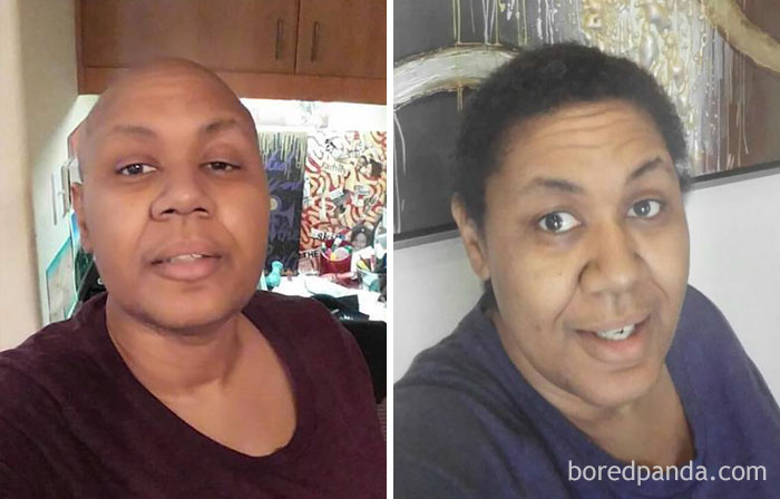 Glad To Have Hair Again