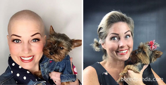 Wow!!! I've Come A Long Way Baby! That Bald Picture Was Taken In December 2016 And Look At Me Now