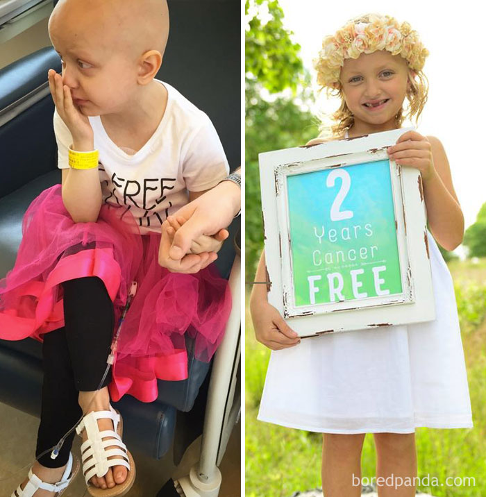 2 Years Cancer Free!