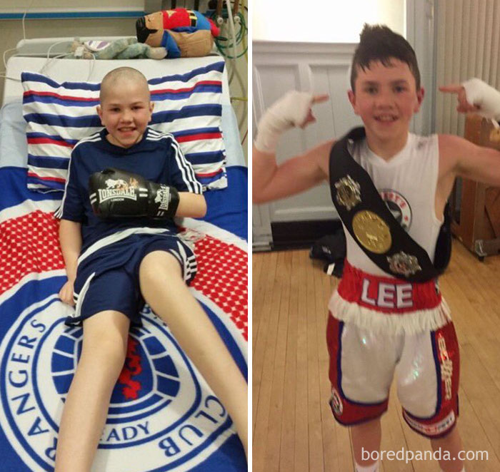 Here's My Little Friend Before And After Cancer