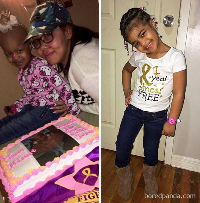 What A Difference A Year Makes. My Baby Is Year Cancer Free!