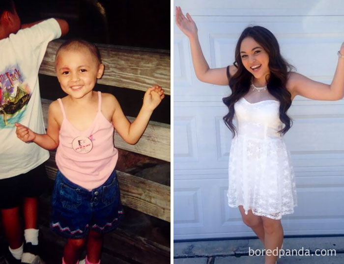 Then And Now! Survived Cancer And Highschool