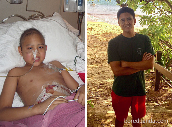 Blessed To Be Celebrating 8 Years Cancer Free!