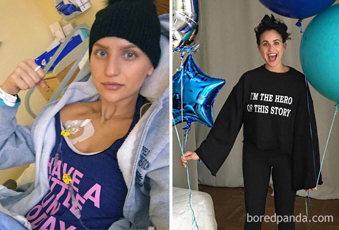 It's Official. This Time I Am Actually 1 Year Cancer Free! This Is The First Time In 3+ Years That I Am Able To Say I Am Clear For 365 Days