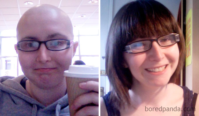 Recently Broke The 2-Year Milestone. Ovarian Cancer Can Happen To Young People Too. Lack Of Awareness Nearly Screwed Me Over, I Was Very Lucky