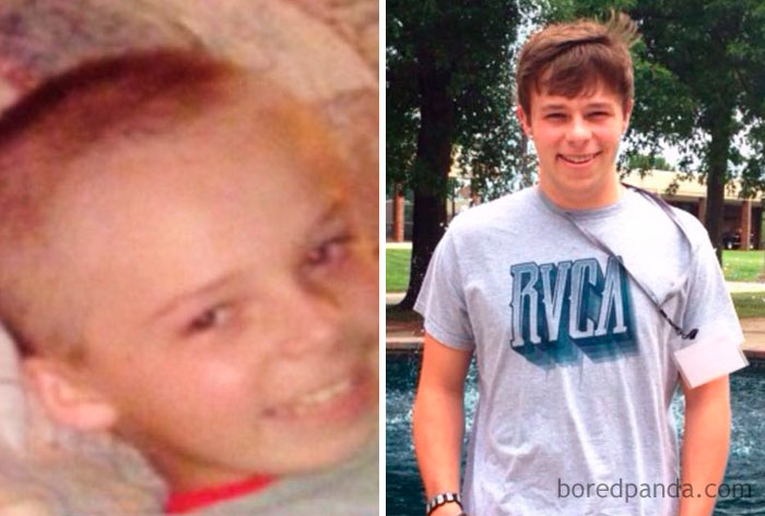 8 Years Cancer Free And Enjoying Life At College