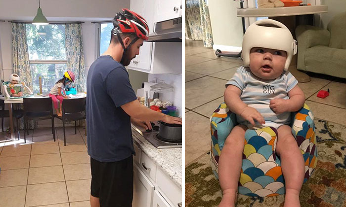 Este bebé necesita llevar casco, así que toda la familia decide acompañarlo