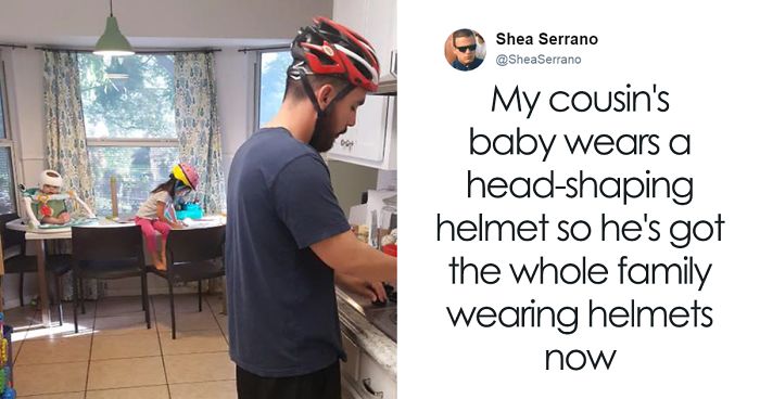 This Baby Has To Wear A Helmet So The Whole Family Decides To Step In