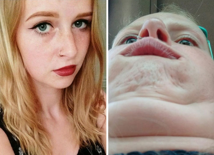 My Chin Has Its Own Zipcode