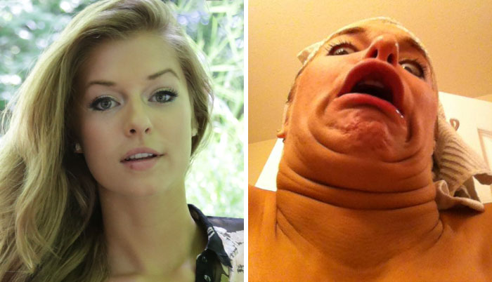 You Guys Asked For Make-Up Free Photos. I Am So, So Sorry