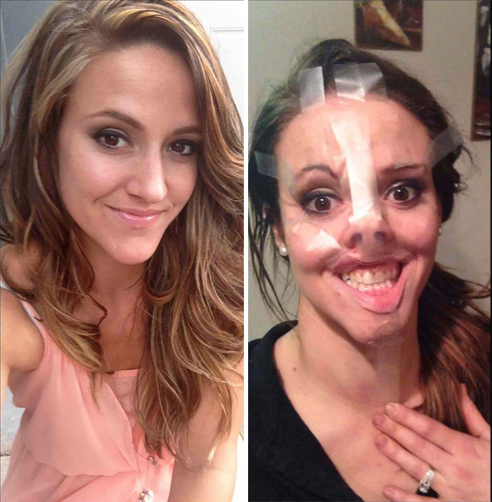 At Home Face Lift Looks Good Huh?