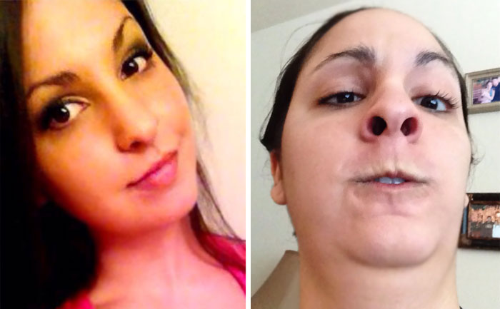 I Tried To Make My Nostrils As Big As I Could