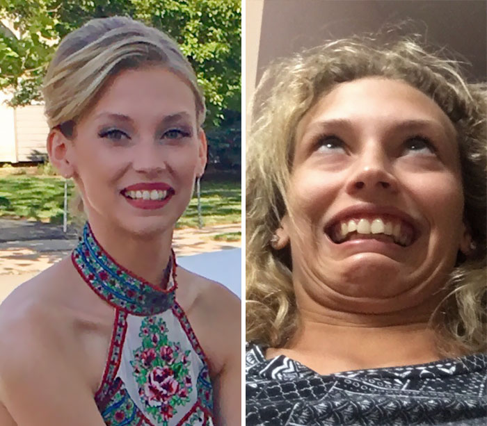 I Usually Try To Hide The Fact My Teeth Aren't Straight