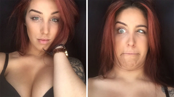 Can You Strain An Eyeball?