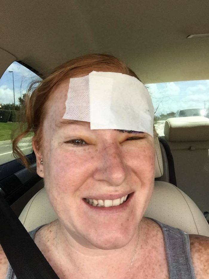 If This Mom's Before & After Photos Don't Scare You About Skin Cancer, Nothing Will If This Mom's Before & After Photos Don't Scare You About Skin Cancer, Nothing Will
