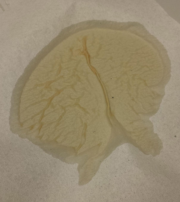 My Coffee Spill Clean-up Looks Like A Brain