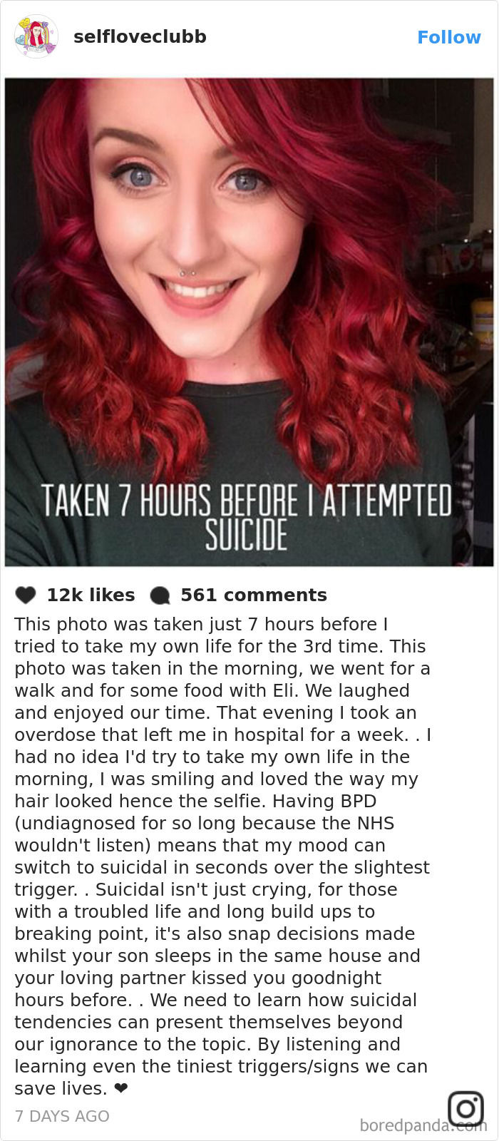 Smiling person showing that depression symptoms have no face, just hours before attempting s*****e.