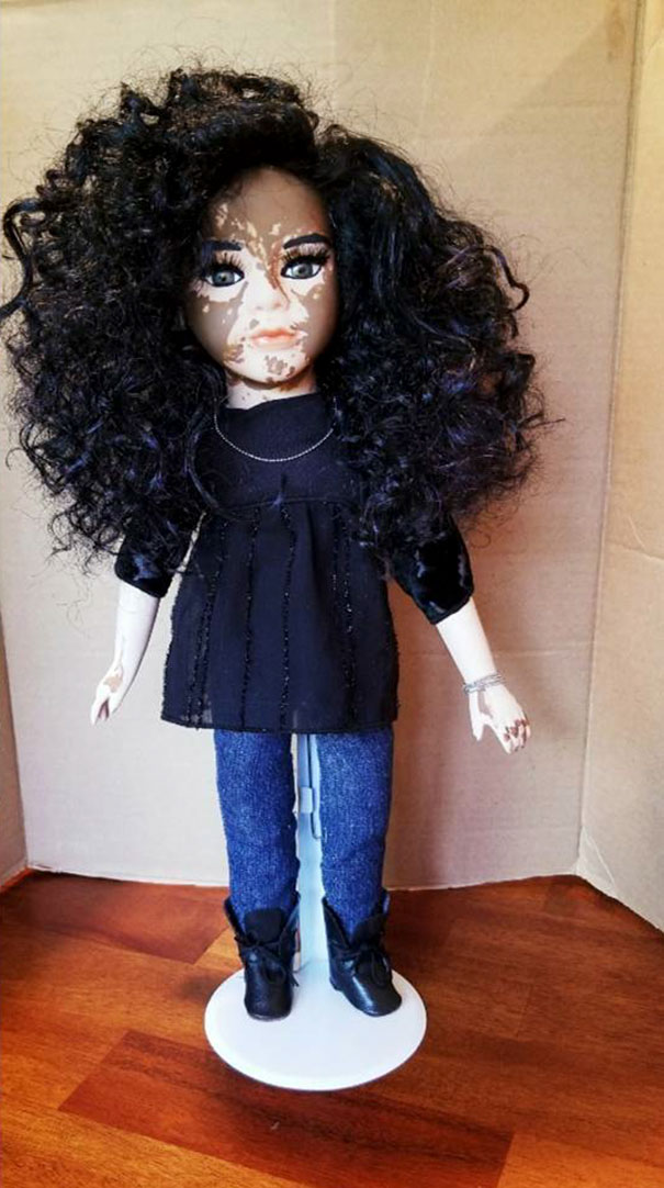 Artist Creates Dolls With Vitiligo For Kids With This Rare Skin Condition Artist Creates Dolls With Vitiligo For Kids With This Rare Skin Condition