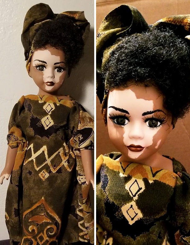 Artist Creates Dolls With Vitiligo For Kids With This Rare Skin Condition Artist Creates Dolls With Vitiligo For Kids With This Rare Skin Condition