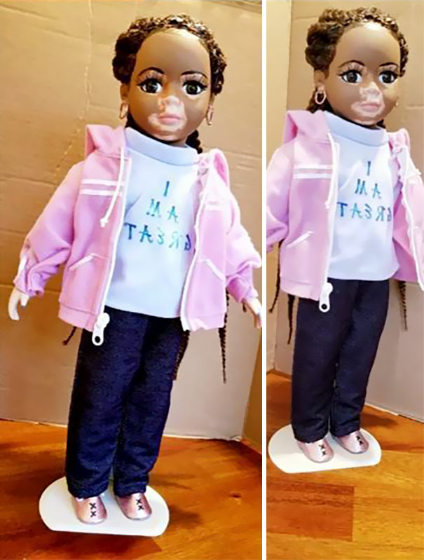 Artist Creates Dolls With Vitiligo For Kids With This Rare Skin Condition Artist Creates Dolls With Vitiligo For Kids With This Rare Skin Condition
