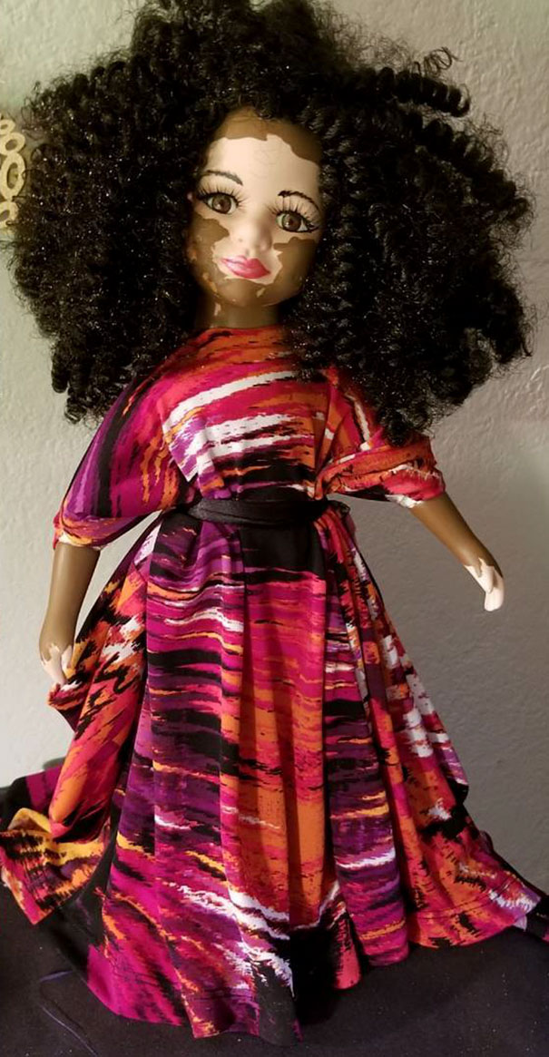 Artist Creates Dolls With Vitiligo For Kids With This Rare Skin Condition Artist Creates Dolls With Vitiligo For Kids With This Rare Skin Condition
