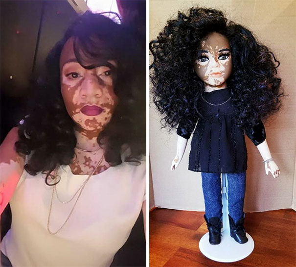 Artist Creates Dolls With Vitiligo For Kids With This Rare Skin Condition Artist Creates Dolls With Vitiligo For Kids With This Rare Skin Condition