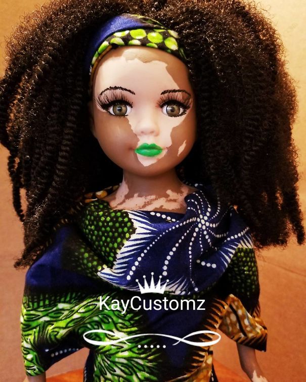 Artist Creates Dolls With Vitiligo For Kids With This Rare Skin Condition Artist Creates Dolls With Vitiligo For Kids With This Rare Skin Condition