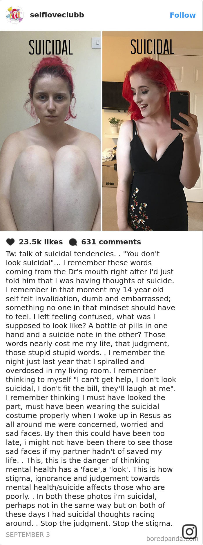 Side-by-side images of a woman with depression symptoms; one serious, one smiling, challenging stereotypes.