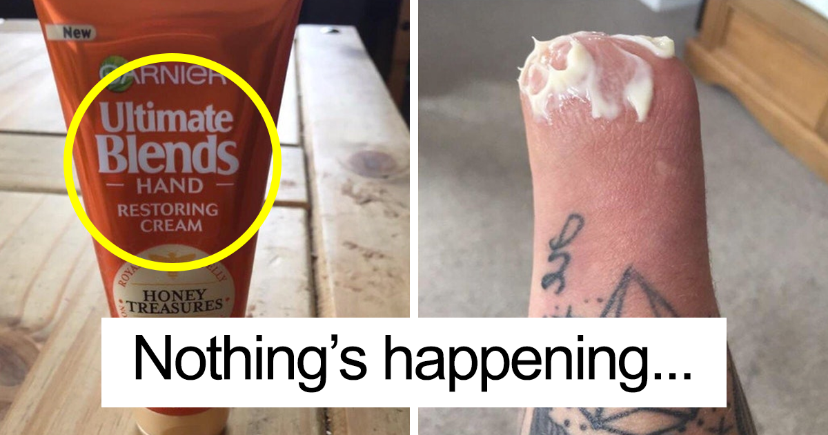 51 Hilarious Amputees Who Lost Their Limbs, But Not Their Sense Of Humor