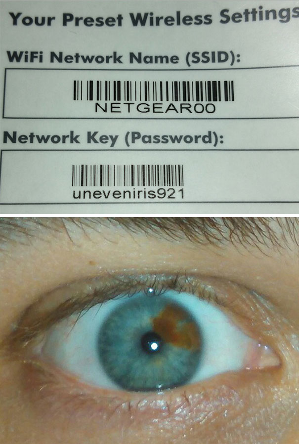 My Default Router Password Described My Rare Birthmark