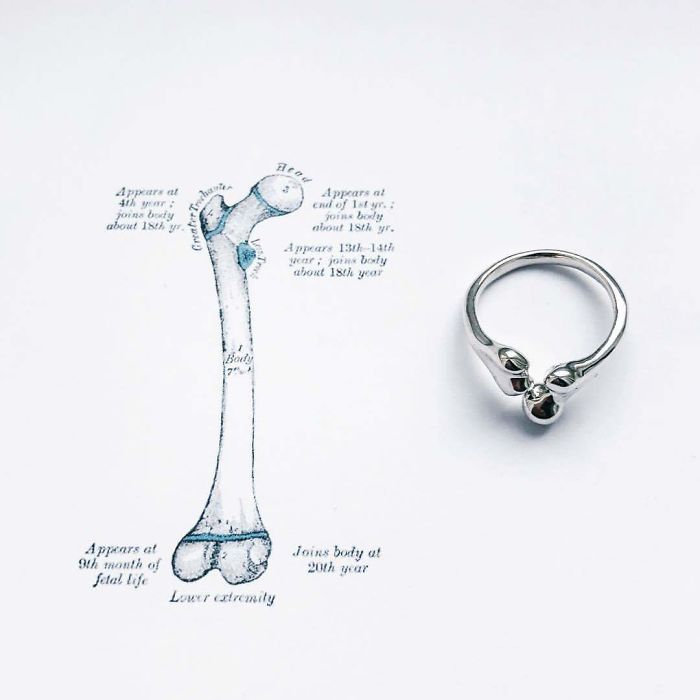 Femur Ring
