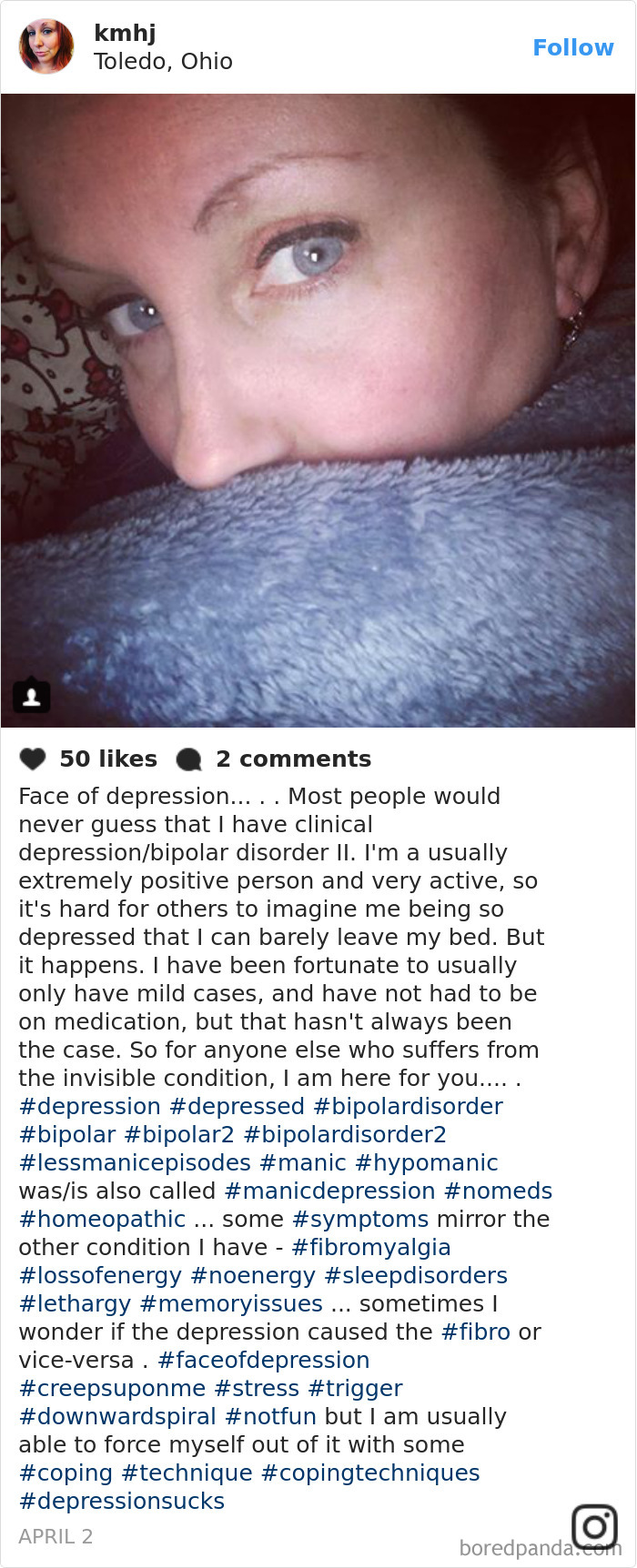 A person with blue eyes partially covered by a blanket, illustrating that depression symptoms have no face.