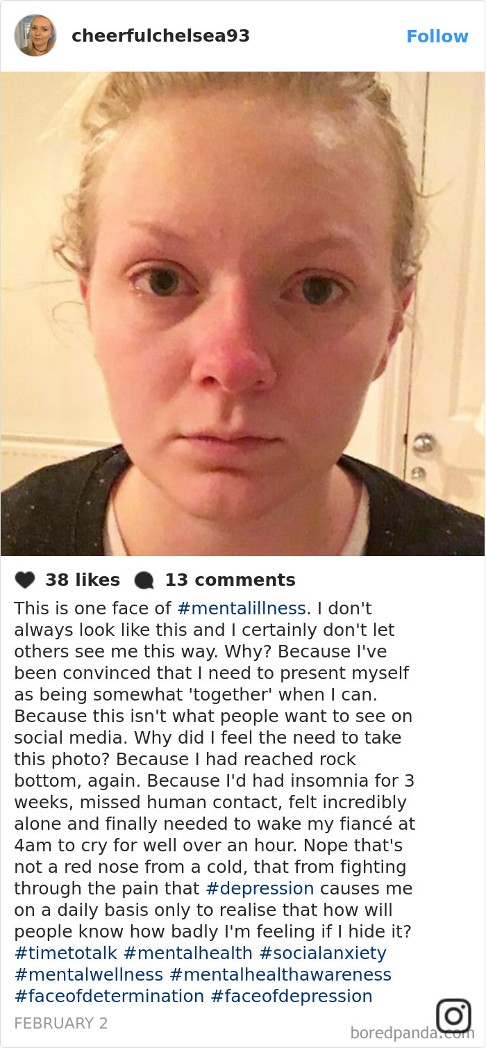 Close-up of a person showing depression symptoms, illustrating that mental illness has no specific face.