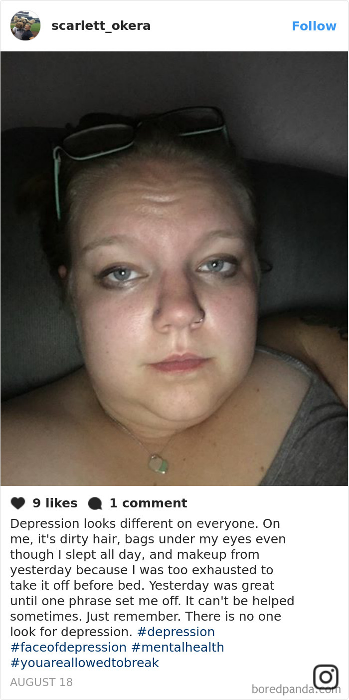 A person with glasses on their head, exhibiting the face of depression, and looking directly at the camera.