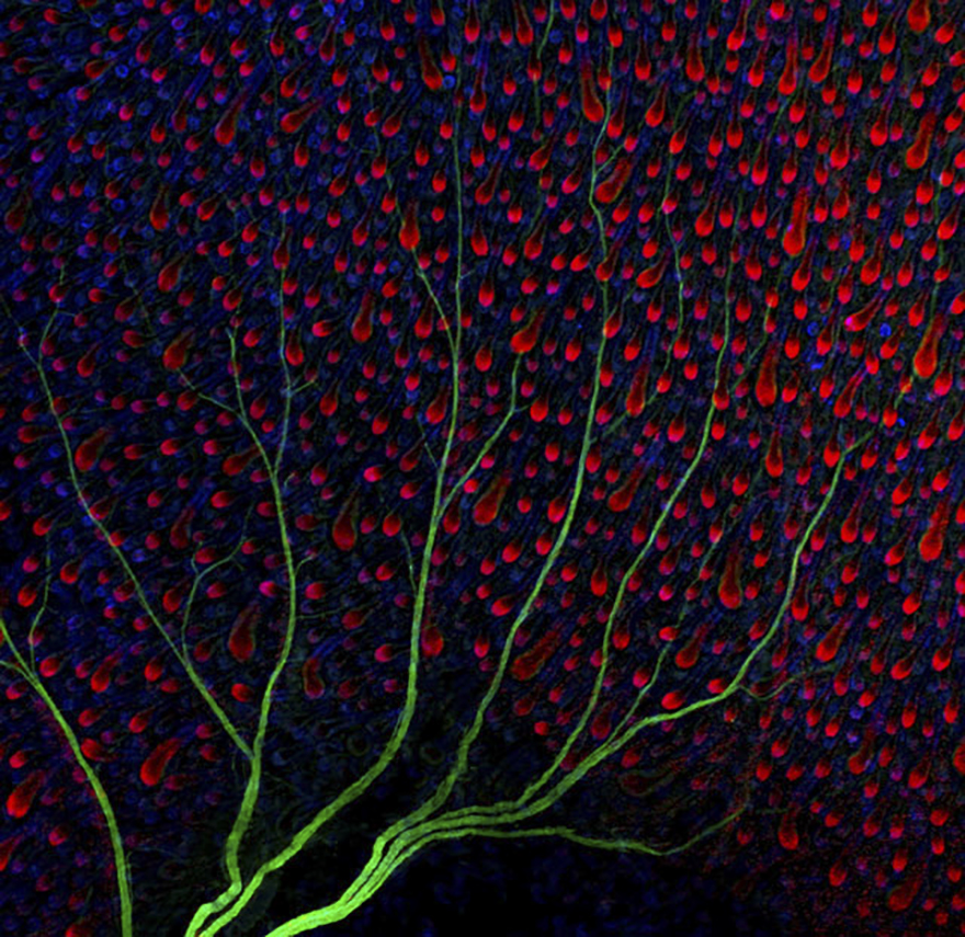 Nerves (In Green) Under The Skin Of A Mouse (Hair Follicles Are Shown In Red And Blue), Uk, Image Of Distinction