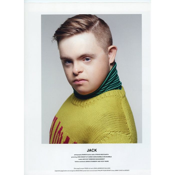 First Male Super Model Who Has Downs Syndrome