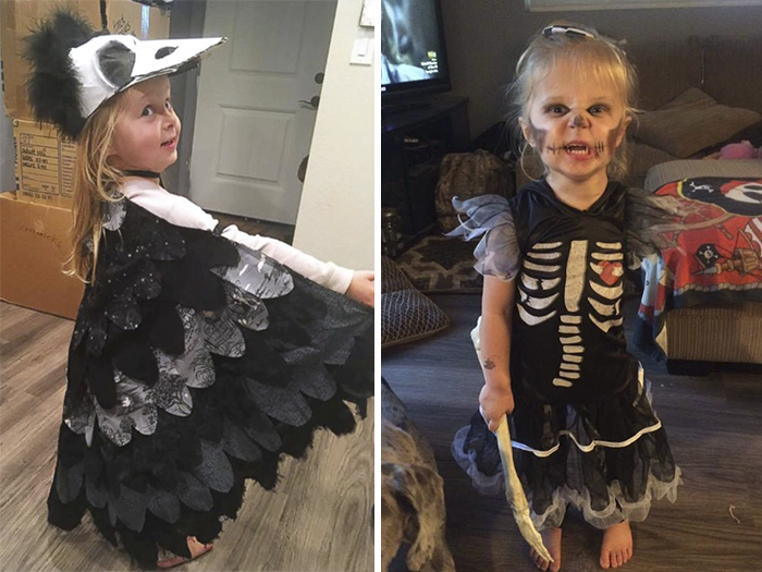 Mother Creates Halloween Costumes For Her 3-Year-Old Who Had Her Arm Amputated Because Of Cancer Mother Creates Halloween Costumes For Her 3-Year-Old Who Had Her Arm Amputated Because Of Cancer