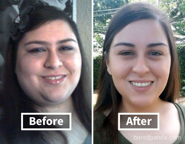 Face fat loss shown in before and after weight loss images of a smiling woman.