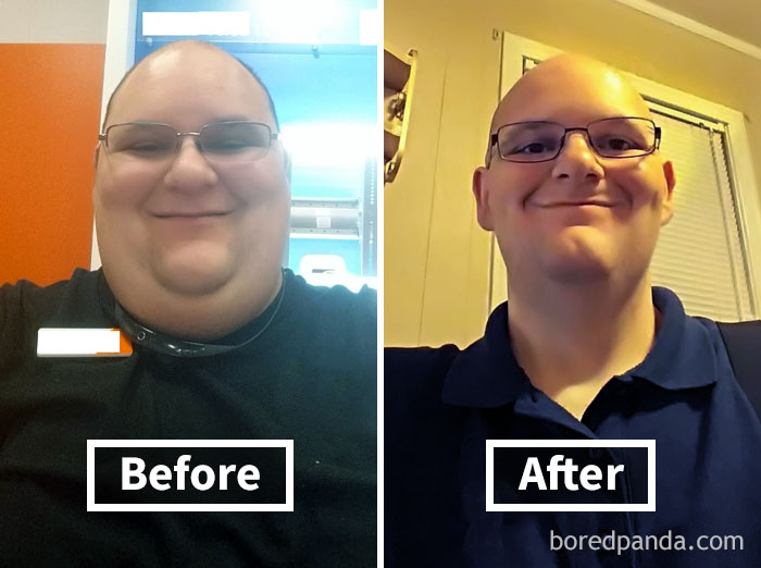 Before and after photos showing face fat loss and weight reduction in a person wearing glasses.