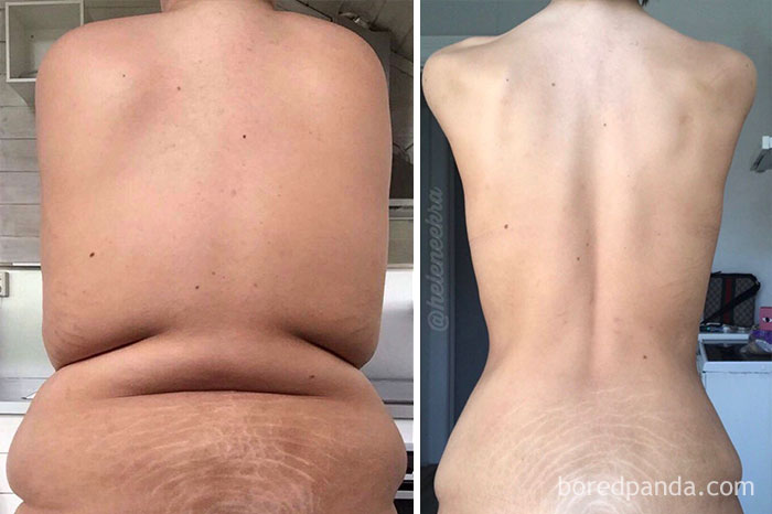 300 Lbs To 150 Lbs In 2 Years. A New Life!