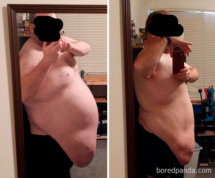 Before and after weight loss transformation, showing a significant change in body size.