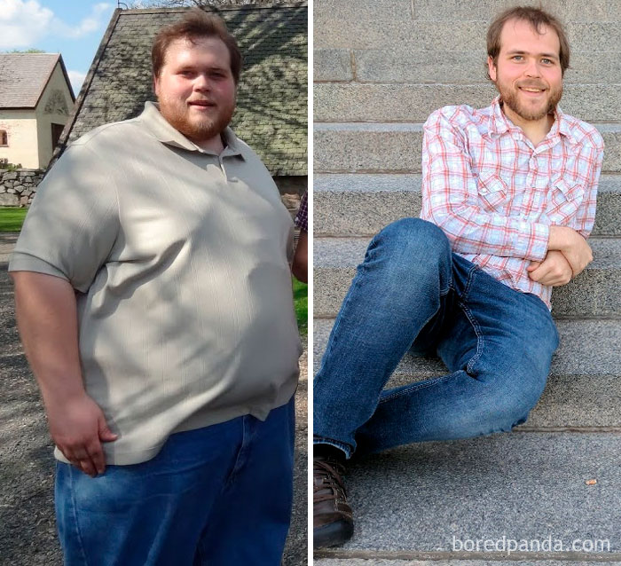 425 Lbs (193 Kg) To 175 Lbs Weight Loss. One Year Done In Maintenance