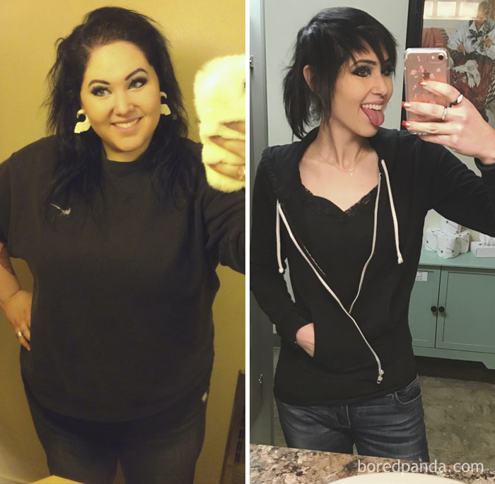 Before And After. 187 Pounds Lost