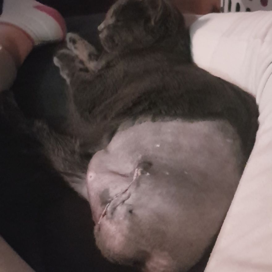 Then, As If Being Attacked By Birds Wasnt Bad Enough, Fella Lost His Leg Recently.