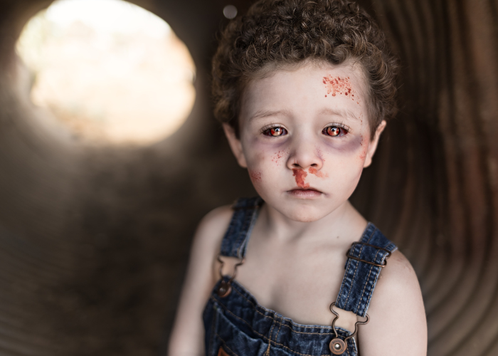 I Turn My Clients Into Zombies