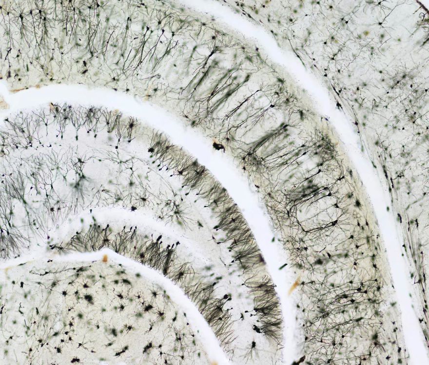 Hippocampal (Brain) Region, California, Image Of Distinction